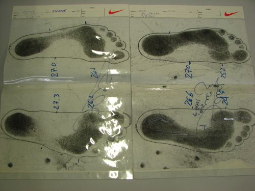 образец ног Давида Луиса (Челси), а слева - Эванс (МЮ)